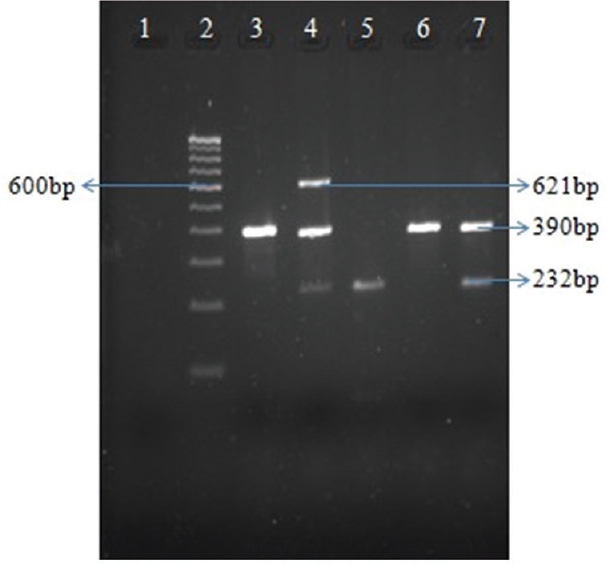 Multiplex polymerase chain reaction for detection of metallo-beta-lactamase-encoding genes. Lane 1, negative control; lane 2, 100 bp ladder; lane 3, PA32 (VIM positive); lane 4, PA44 (VIM, IMP, NDM positive); lane 5, PAE181 (IMP positive); lane 6, PA27 (VIM positive); lane 7, PAE180 (IMP, VIM positive).